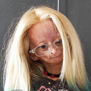 Adalia Rose Wiki, Age, Death, Parents, Net Worth
