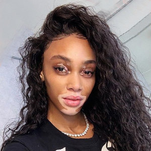 Who Is Winnie Harlow's Boyfriend? Dating Life, Parents, Net Worth